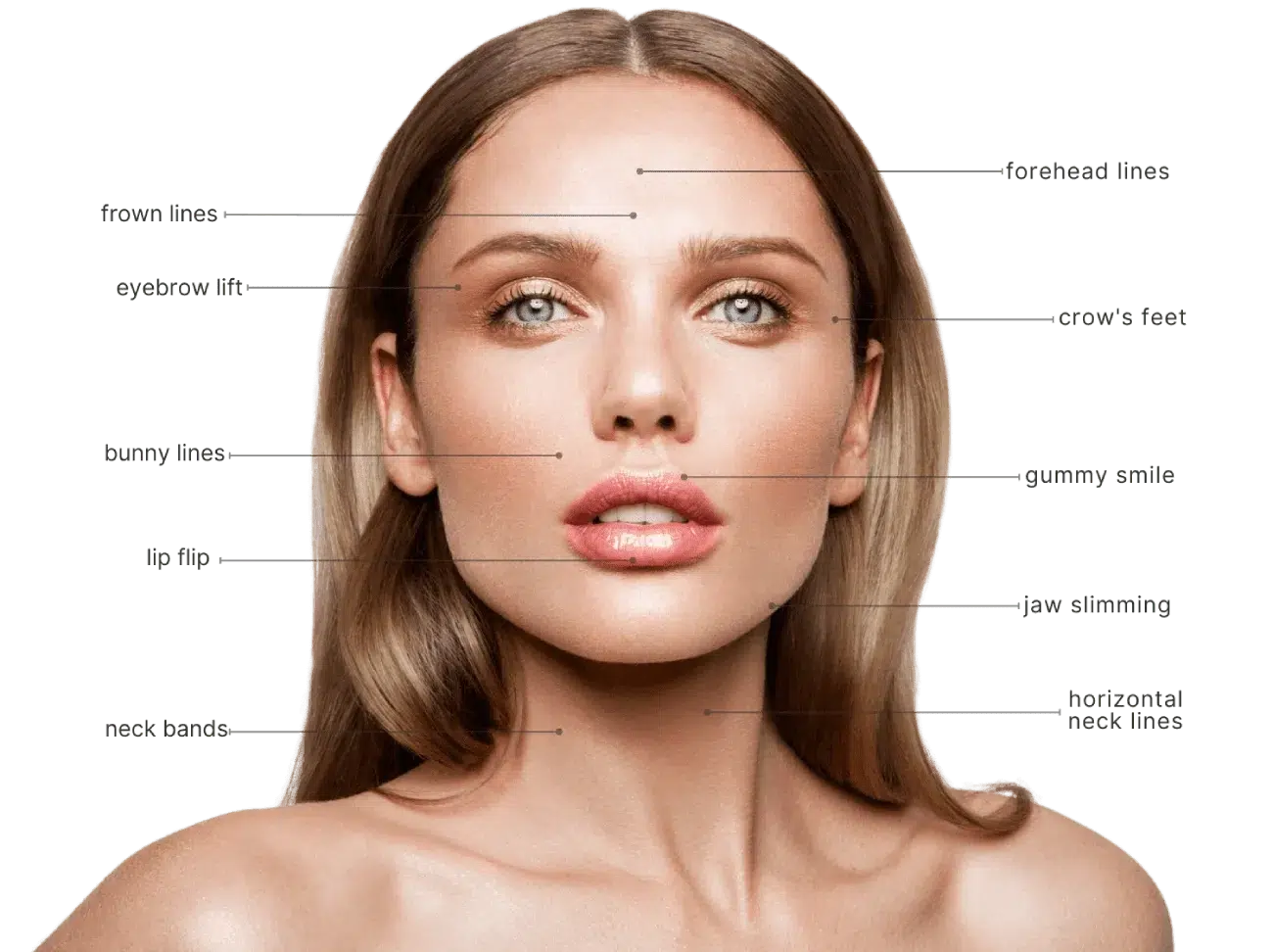 An image showing the parts of the face for a Botox treatment.